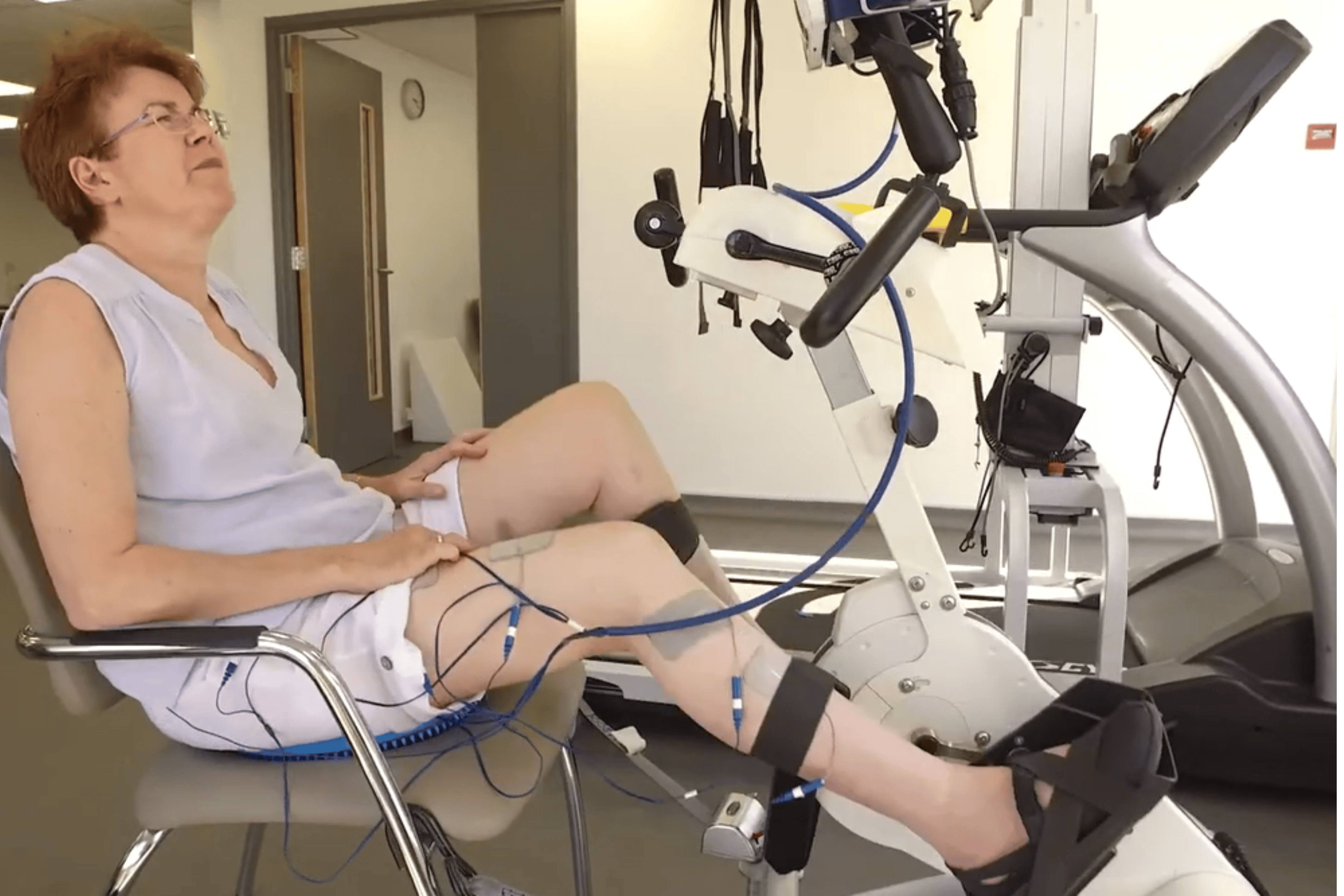 What is FES (Functional Electrical Stimulation) Cycling? image